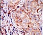 TRIB3 Antibody in Immunohistochemistry (IHC)