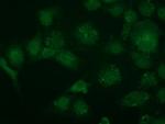 TRIM2 Antibody in Immunocytochemistry (ICC/IF)