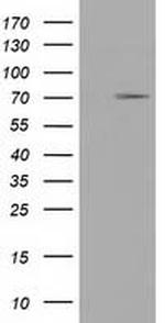 TRIM2 Antibody in Western Blot (WB)