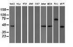 TRIM2 Antibody in Western Blot (WB)