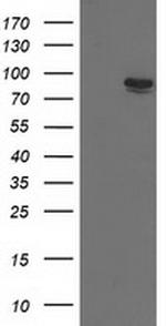 TRIM2 Antibody in Western Blot (WB)