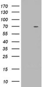 TRIM2 Antibody in Western Blot (WB)