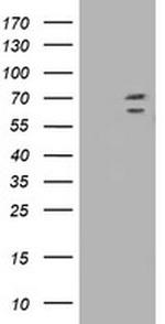 TRIM2 Antibody in Western Blot (WB)