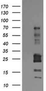 TRIM22 Antibody in Western Blot (WB)