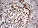 TRIM24 Antibody in Immunohistochemistry (Paraffin) (IHC (P))