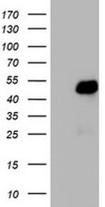 TRIM24 Antibody in Western Blot (WB)