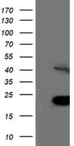 TRIM24 Antibody in Western Blot (WB)
