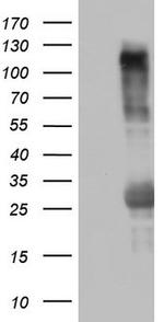 TRIM24 Antibody in Western Blot (WB)