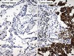 TRIM29 Antibody in Immunohistochemistry (Paraffin) (IHC (P))