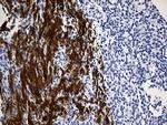 TRIM29 Antibody in Immunohistochemistry (Paraffin) (IHC (P))