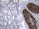 TRIM29 Antibody in Immunohistochemistry (Paraffin) (IHC (P))