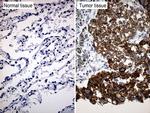 TRIM29 Antibody in Immunohistochemistry (Paraffin) (IHC (P))