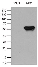 TRIM29 Antibody in Western Blot (WB)