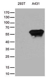TRIM29 Antibody in Western Blot (WB)