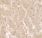 TRIM33 Antibody in Immunohistochemistry (IHC)