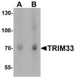 TRIM33 Antibody in Western Blot (WB)