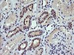 TRIM38 Antibody in Immunohistochemistry (Paraffin) (IHC (P))