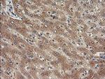 TRIM38 Antibody in Immunohistochemistry (Paraffin) (IHC (P))