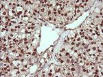 TRIM38 Antibody in Immunohistochemistry (Paraffin) (IHC (P))