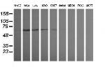 TRIM38 Antibody in Western Blot (WB)