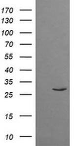TRIM38 Antibody in Western Blot (WB)