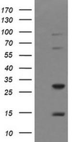 TRIM38 Antibody in Western Blot (WB)