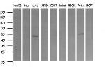 TRIM38 Antibody in Western Blot (WB)