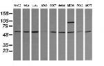 TRIM38 Antibody in Western Blot (WB)