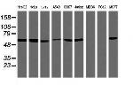 TRIM38 Antibody in Western Blot (WB)