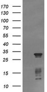 TRIM38 Antibody in Western Blot (WB)