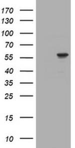 TRIM39 Antibody in Western Blot (WB)