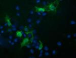 TRIM44 Antibody in Immunocytochemistry (ICC/IF)