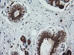 TRIM44 Antibody in Immunohistochemistry (Paraffin) (IHC (P))