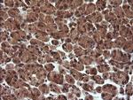 TRIM44 Antibody in Immunohistochemistry (Paraffin) (IHC (P))