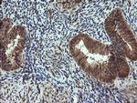 TRIM44 Antibody in Immunohistochemistry (Paraffin) (IHC (P))