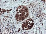 TRIM44 Antibody in Immunohistochemistry (Paraffin) (IHC (P))