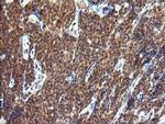 TRIM44 Antibody in Immunohistochemistry (Paraffin) (IHC (P))