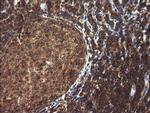TRIM44 Antibody in Immunohistochemistry (Paraffin) (IHC (P))
