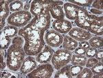 TRIM44 Antibody in Immunohistochemistry (Paraffin) (IHC (P))