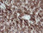 TRIM44 Antibody in Immunohistochemistry (Paraffin) (IHC (P))