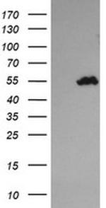 TRIM44 Antibody in Western Blot (WB)