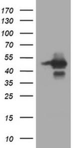 TRIM44 Antibody in Western Blot (WB)