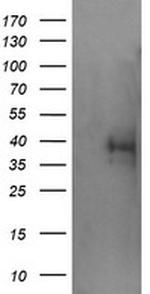 TRIM44 Antibody in Western Blot (WB)
