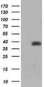 TRIM44 Antibody in Western Blot (WB)