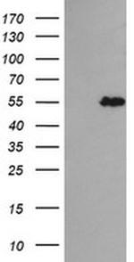TRIM44 Antibody in Western Blot (WB)