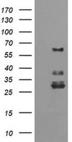 TRIM45 Antibody in Western Blot (WB)
