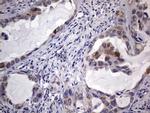 TRIM54 Antibody in Immunohistochemistry (Paraffin) (IHC (P))