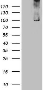 TRIM56 Antibody in Western Blot (WB)