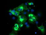 TRIM9 Antibody in Immunocytochemistry (ICC/IF)