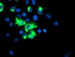 TRIM9 Antibody in Immunocytochemistry (ICC/IF)